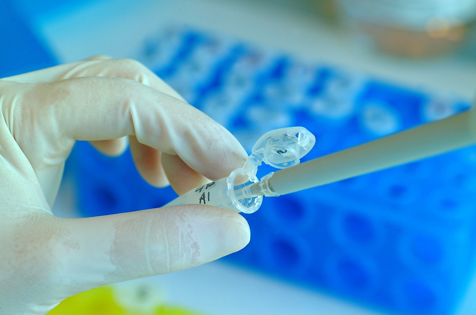 Pubblicato il bando per il Premio Studio per la Ricerca Oncologica di Fondazione Humanitas Sicilia